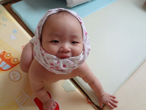 ▲ 포털사이트 다음의 아고라 게시판에 올라온 사진(닉네임 냉냉). 희귀난치성 질환인 '글루타릭산뇨증'을 앓고 있다.     &copy; 다음 아고라 이미지 캡쳐 